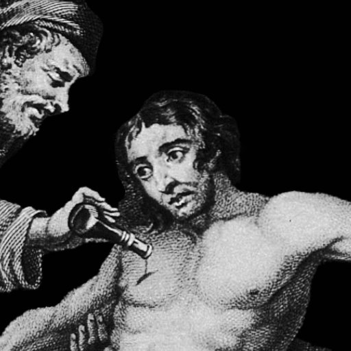 A historical illustration shows one man performing a medical procedure on another man’s chest using a metal instrument, both with serious expressions.